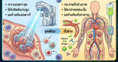 ฉายแสง กับ คีโม ต่างกันยังไง?
